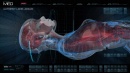 210-airiam-autopsy-scan.jpg